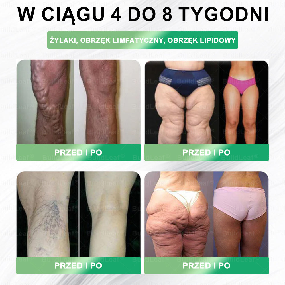 🌿🌿🌿Oficjalny sklep Polska | BuildLeaf® GLP-1 8-w-1 Fit & Vital Rozwiązanie (Jednorazowe dziennie, widoczne zmiany w ciągu 7 dni) ✅ Otyłość, zdrowie sercowo-naczyniowe, cukrzyca, bezdech senny, zdrowie jelit, problemy ze stawami i inne.