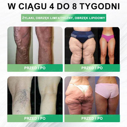 🌿🌿🌿Oficjalny sklep Polska | BuildLeaf® GLP-1 8-w-1 Fit & Vital Rozwiązanie (Jednorazowe dziennie, widoczne zmiany w ciągu 7 dni) ✅ Otyłość, zdrowie sercowo-naczyniowe, cukrzyca, bezdech senny, zdrowie jelit, problemy ze stawami i inne.